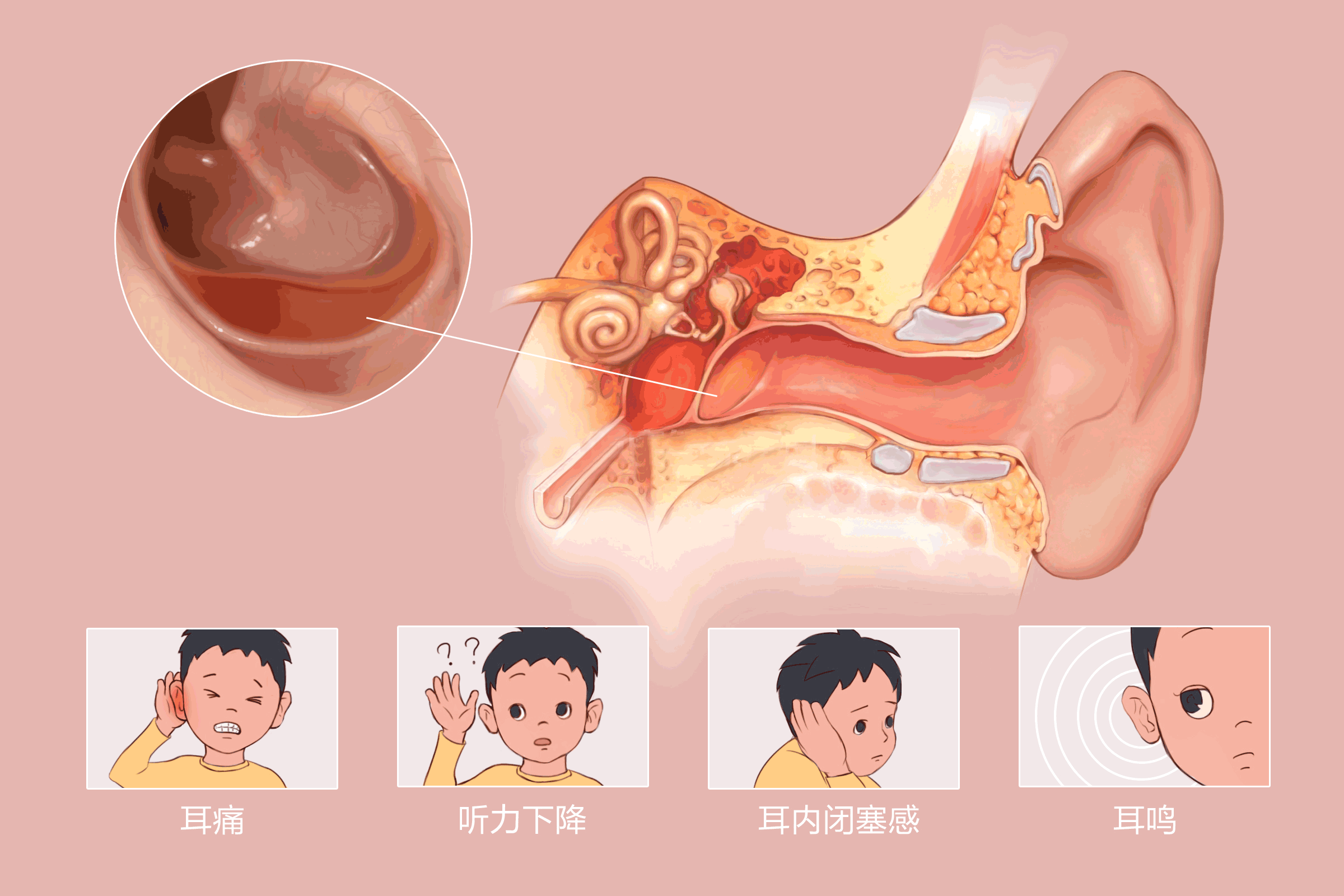 耳朵疼痛闷堵是中耳炎引起的吗?